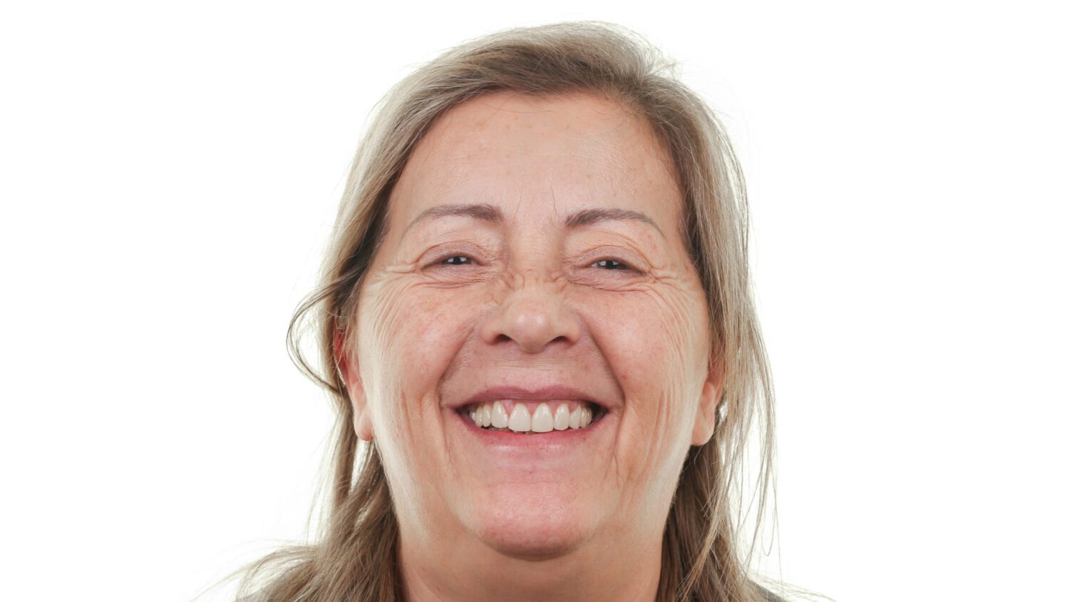 ana-maria-rocha-depois