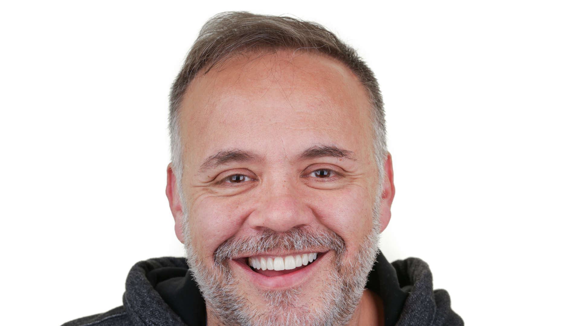 antonio-moutinho-depois