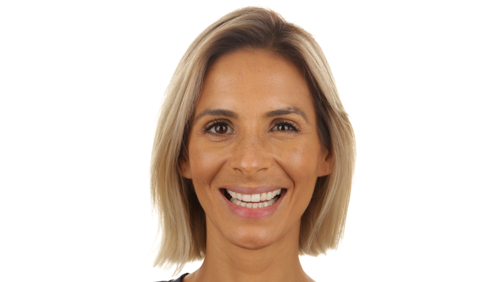 catarina-camanho-depois