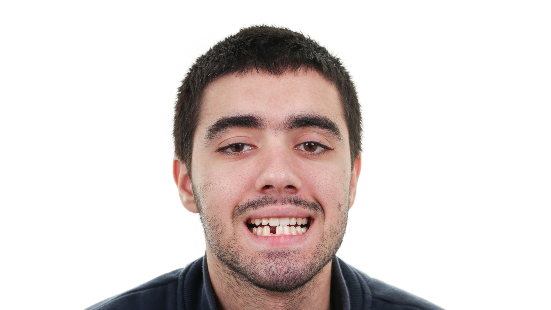 diogo-soares-antes
