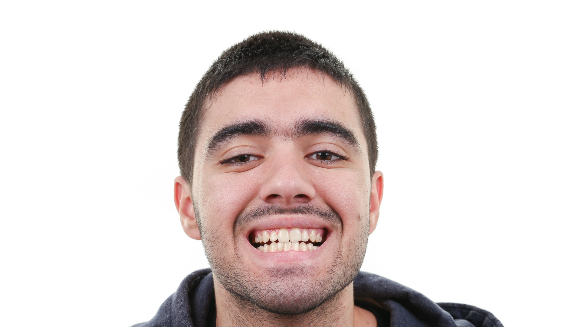 diogo-soares-depois