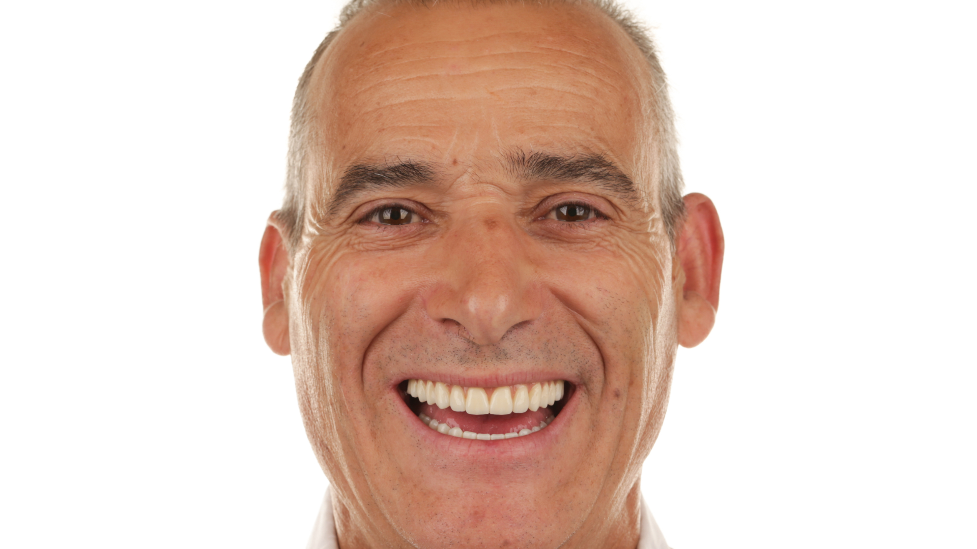 jose-giesta-depois
