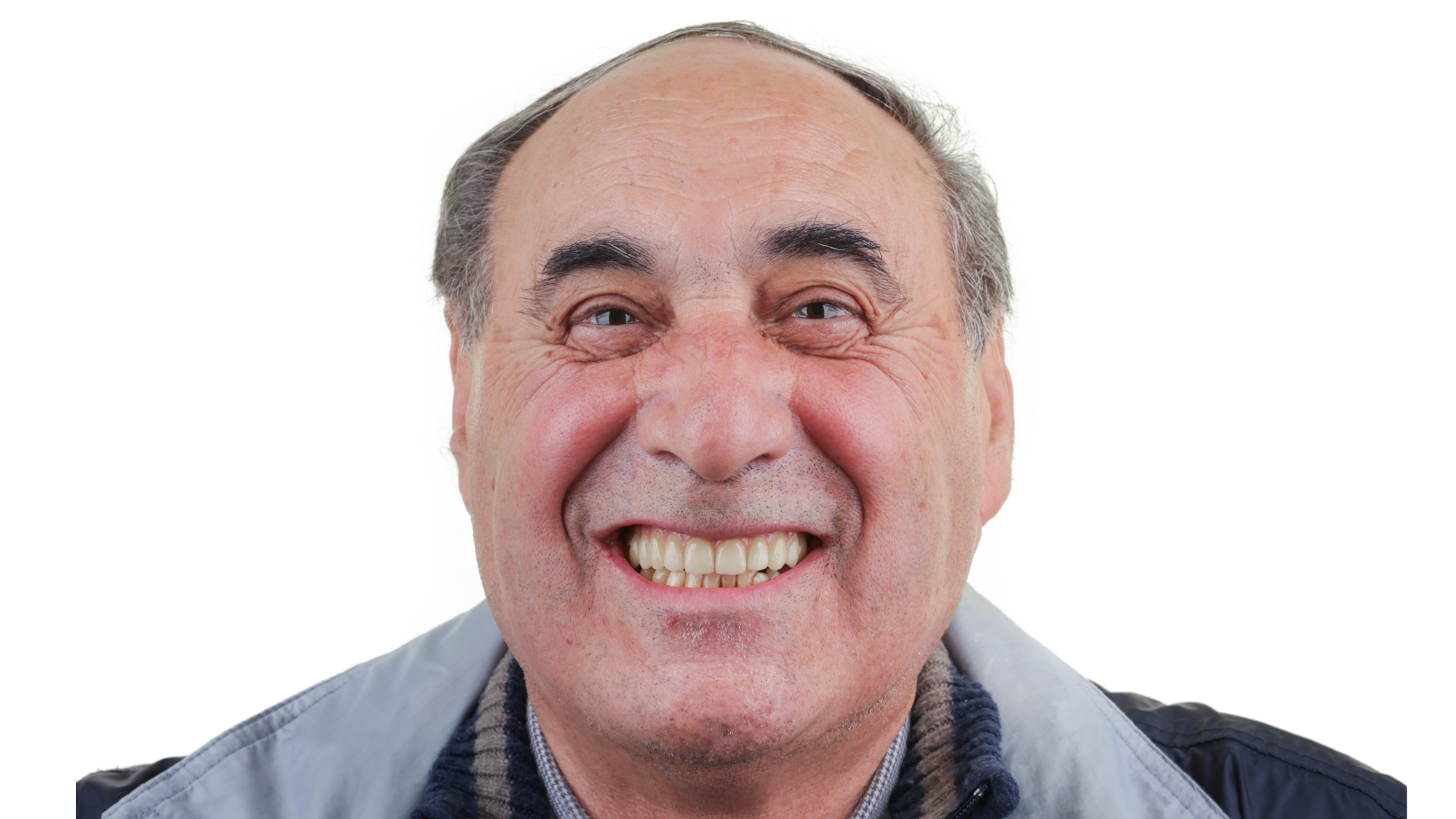 manoel-costa-depois